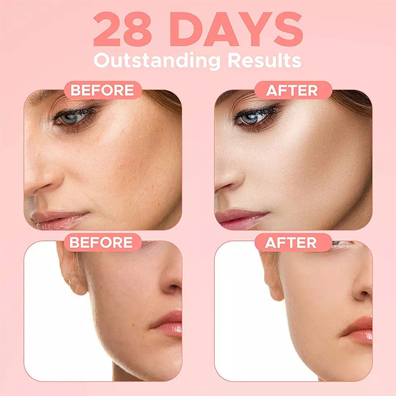FaceNutrient Acne Serum